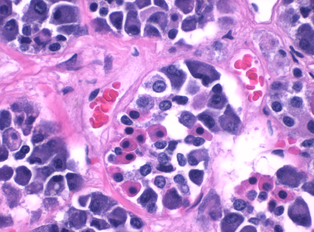 Sermorelin: The Secretagogue With a Real Licence and a Narrow Mandate