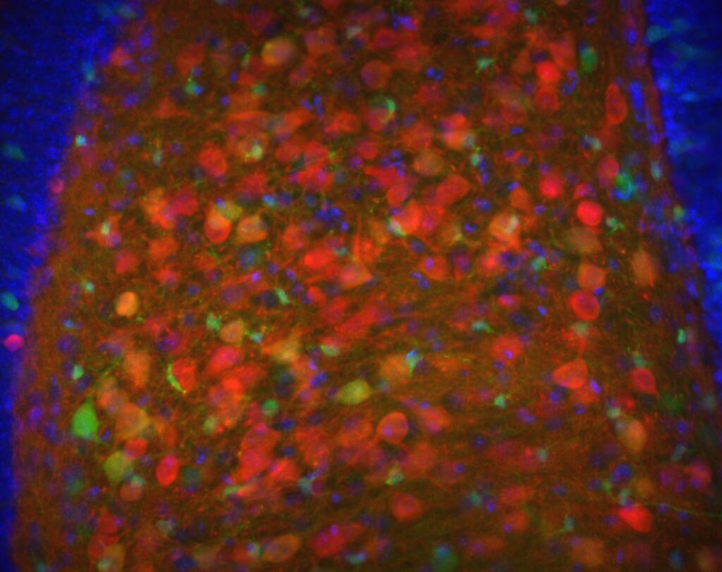 P21: The Neurogenesis Peptide That Has Never Met a Human