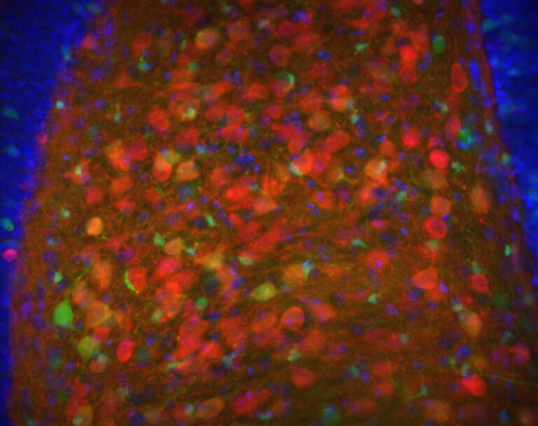 P21: The Neurogenesis Peptide That Has Never Met a Human