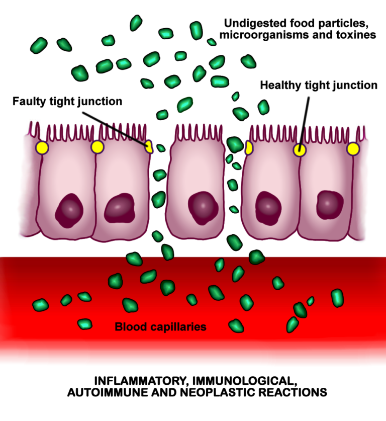 What Is Larazotide? The One &ldquo;Leaky Gut&rdquo; Peptide That Reached a Phase III Trial