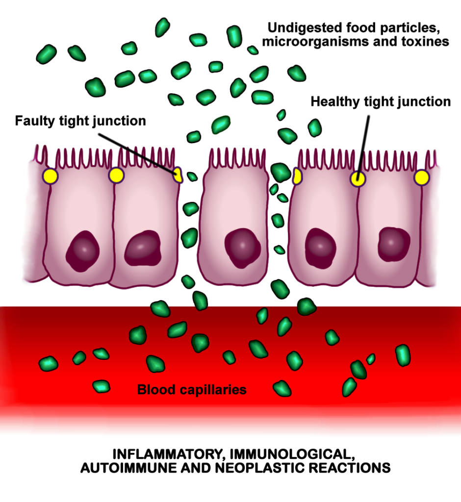 What Is Larazotide? The One &ldquo;Leaky Gut&rdquo; Peptide That Reached a Phase III Trial