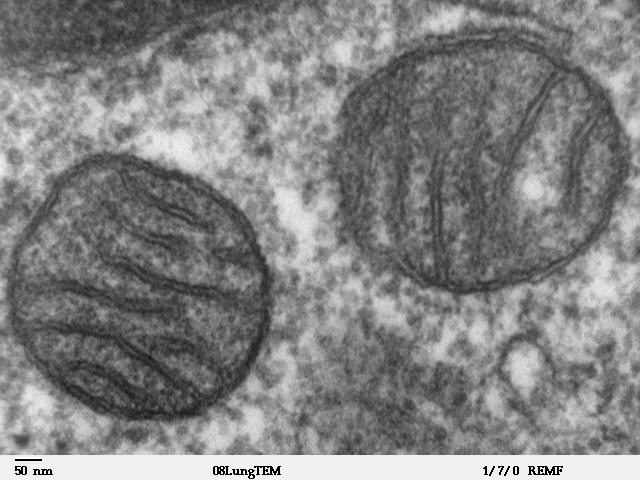 SS-31 (Elamipretide): The Mitochondrial Peptide That Reached the Clinic — and Got Complicated
