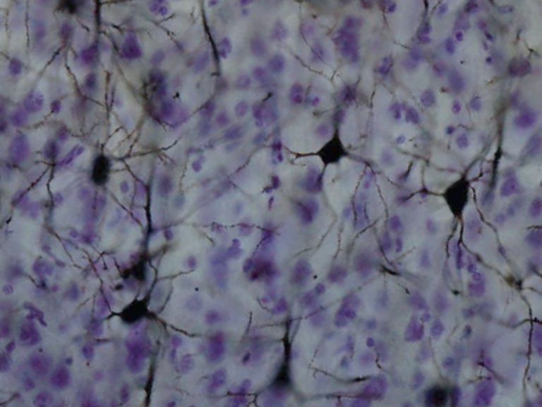 Cerebrolysin: The Most-Used Nootropic the West Won’t Register