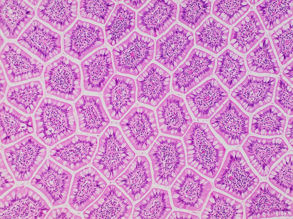“Leaky Gut” Examined: Zonulin, Tight Junctions and Larazotide