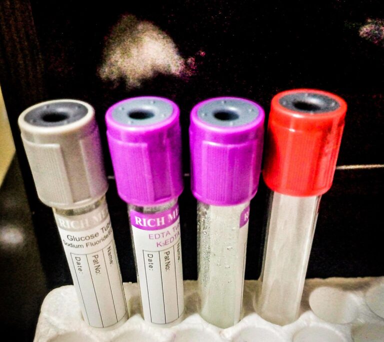 Blood sample tubes in a clinical laboratory rack