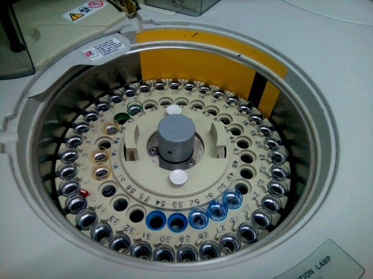 A clinical chemistry analyser used for blood biomarker panels