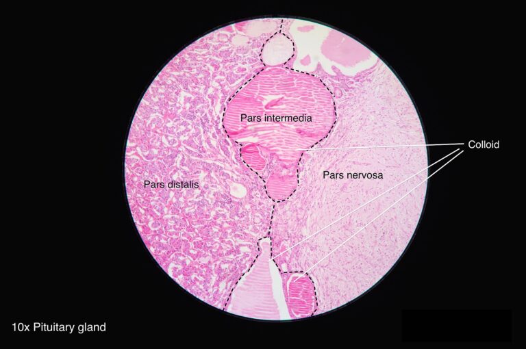 Histology of the pituitary gland, source of growth hormone