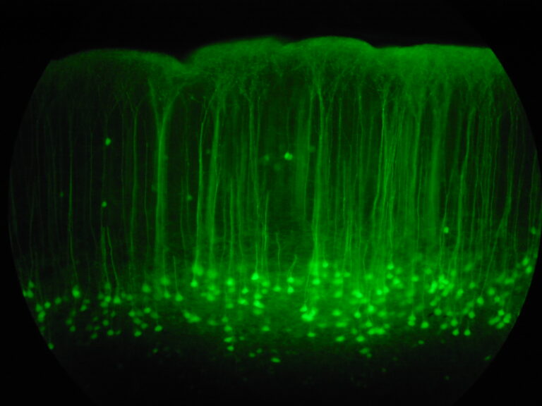 Fluorescence micrograph of a somatosensory cortex brain slice