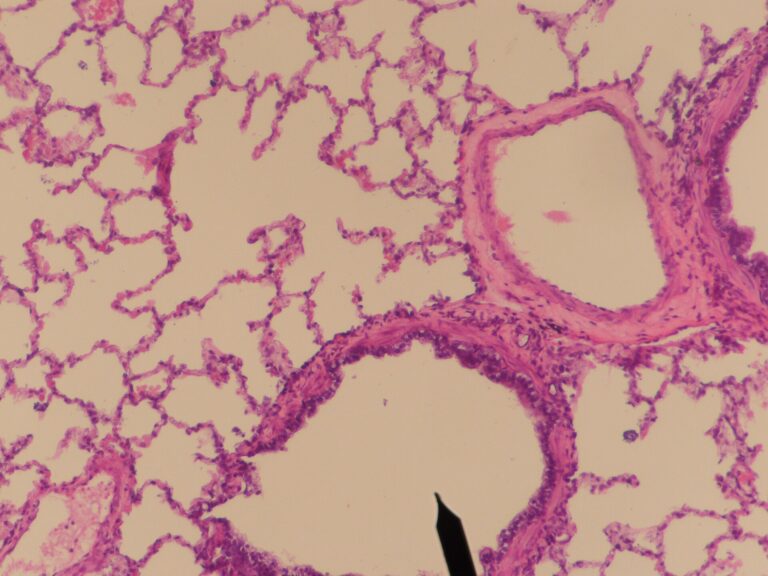 Micrograph of a tertiary bronchus in lung tissue
