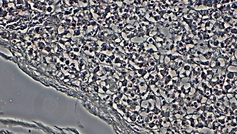 Haematoxylin and eosin stained section of young human pineal gland