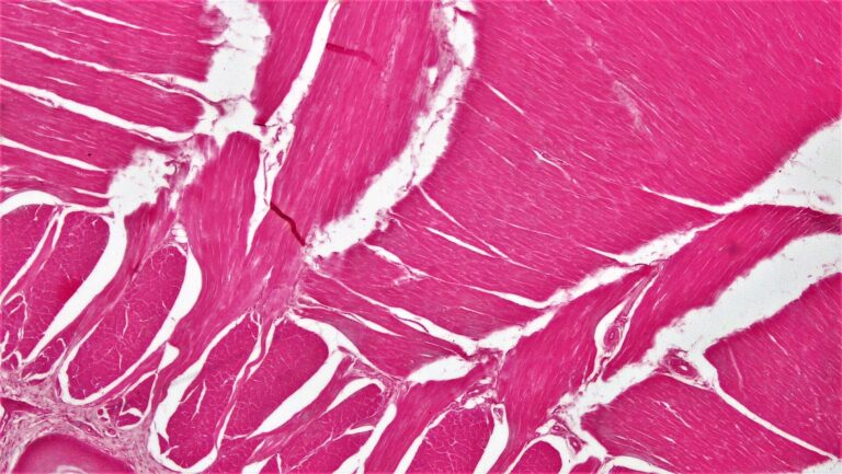 Cross section of whole skeletal muscle tissue