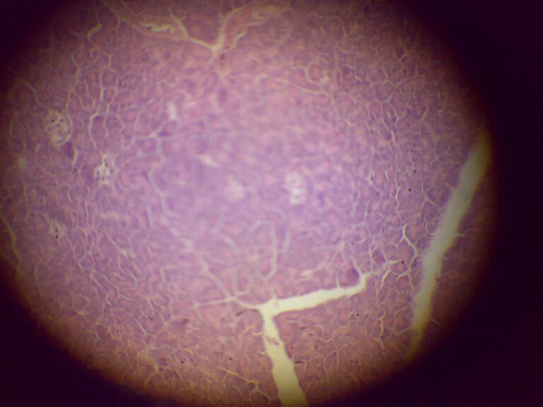 Micrograph of pancreatic tissue showing acinar and islet regions