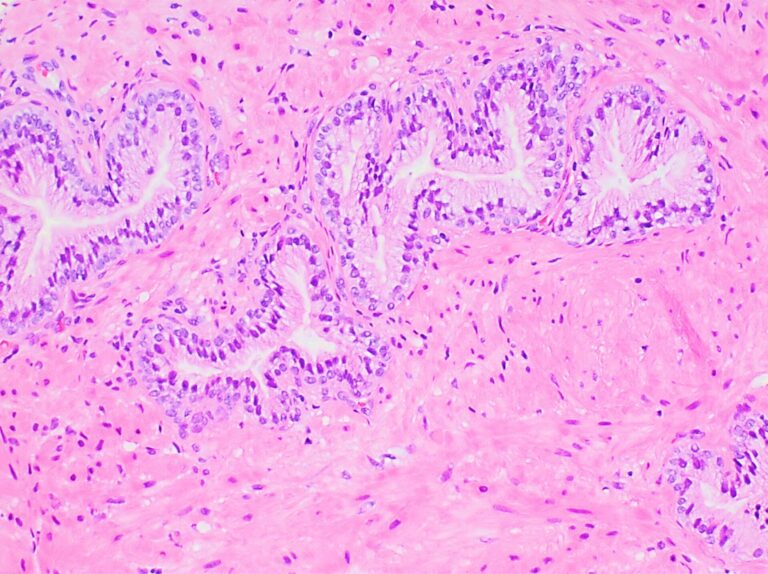 Micrograph of normal prostate gland histology