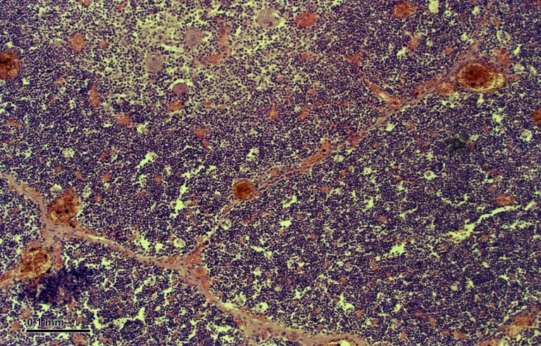What Is Thymalin? Khavinson’s Original Thymus Peptide Bioregulator
