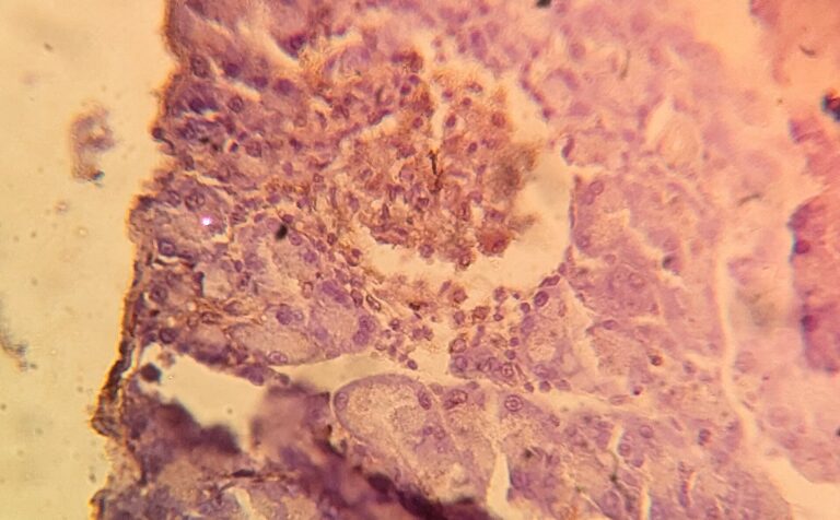 Immunohistochemical detection of insulin in pancreatic islet cells, which also secrete amylin