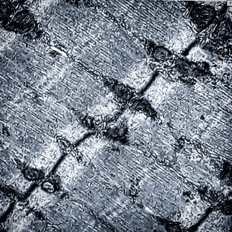 Electron micrograph of skeletal muscle showing mitochondria between myofibrils