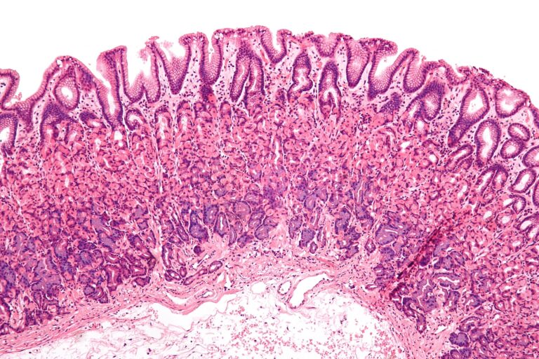 Why Most Peptides Cannot Be Swallowed — and What It Takes to Change That
