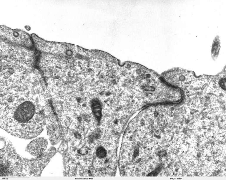 Do Peptides Cross the Blood-Brain Barrier? What the Evidence Actually Shows