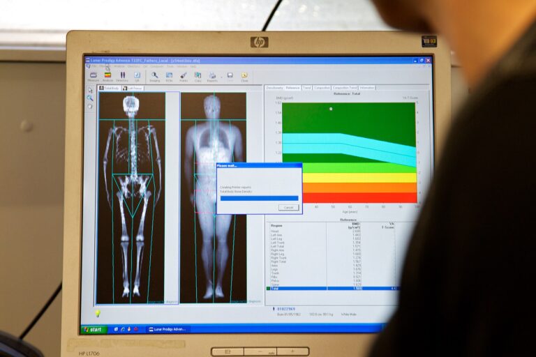 A DEXA scan readout used to measure body composition