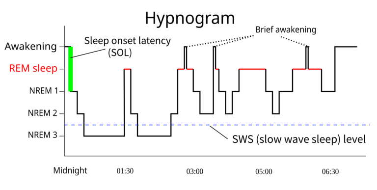 A hypnogram showing the progression of sleep stages across a night