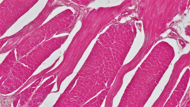 Skeletal muscle histology showing fascicles in cross section separated by connective tissue