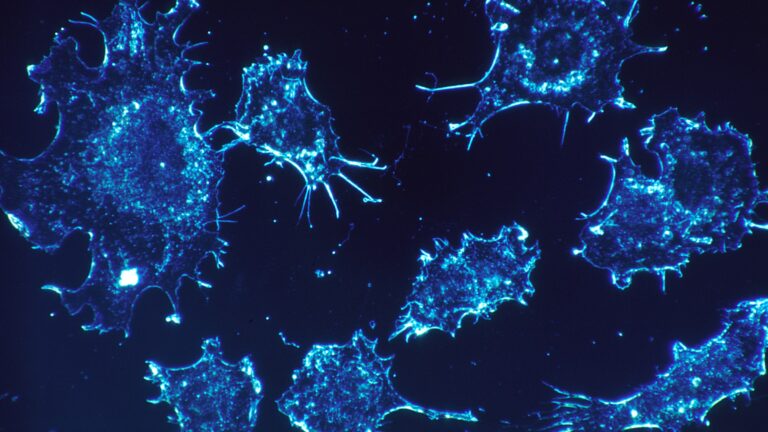 Cancer cells imaged by fluorescence microscopy